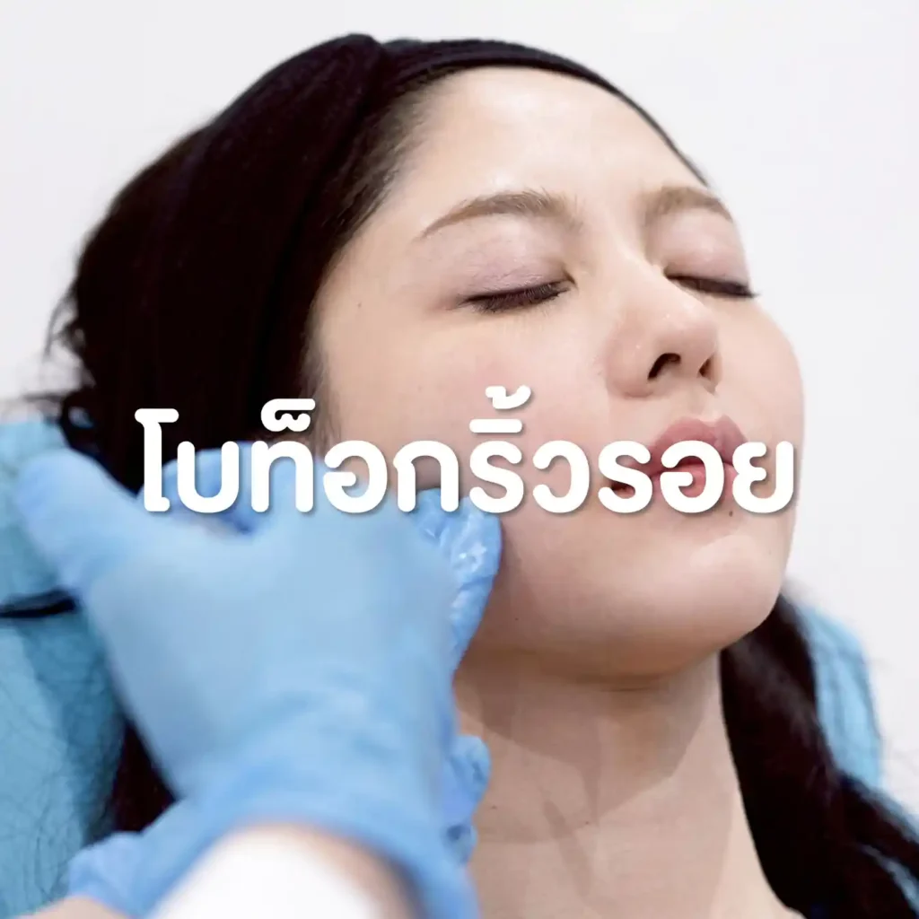 โบท็อกริ้วรอย