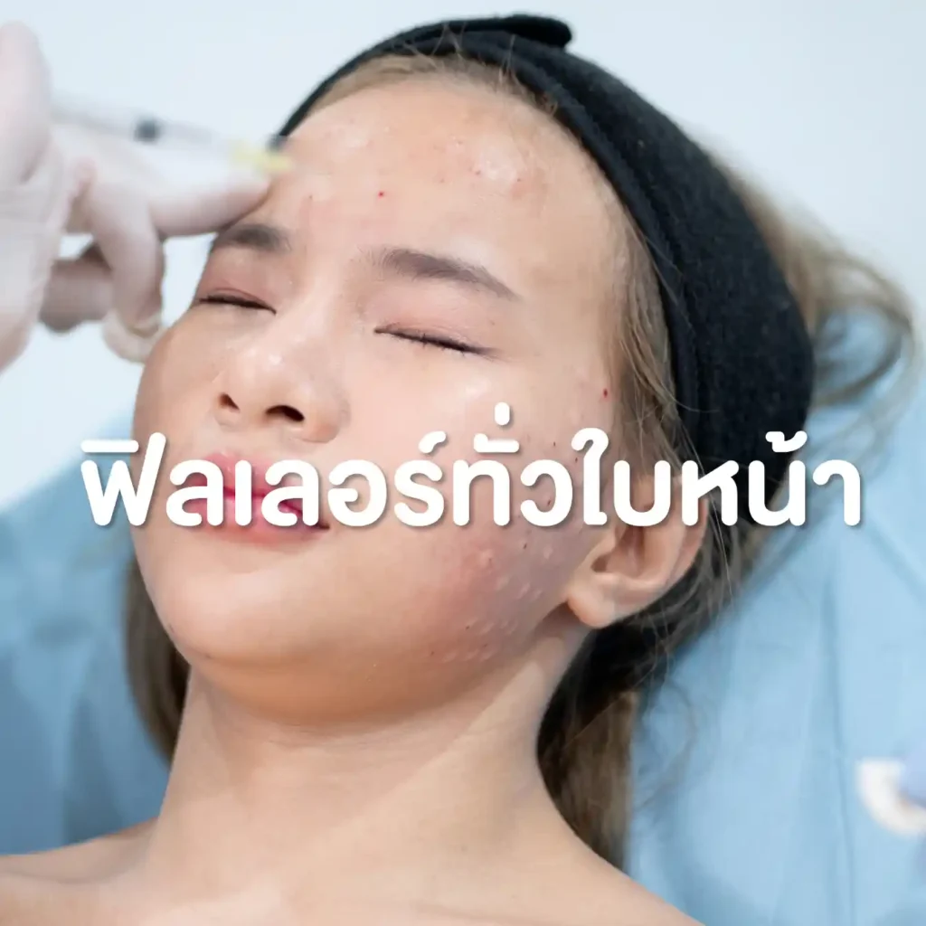 โปรแกรมฉีดฟิลเลอร์ทั่วใบหน้า