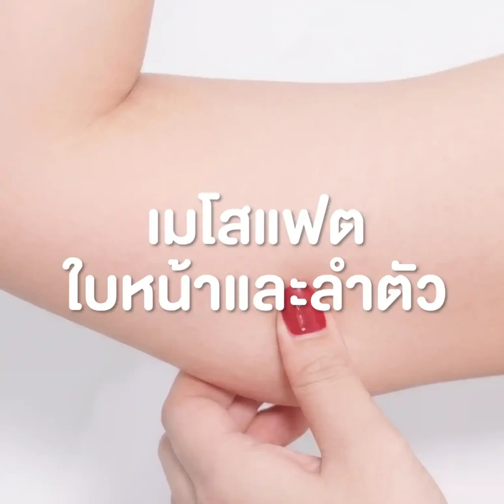 โปรแกรมเมโสแฟต บริเวณใบหน้าและลำตัว