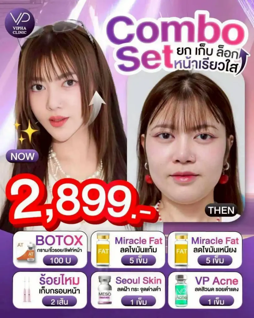 โปรโมชัน 10