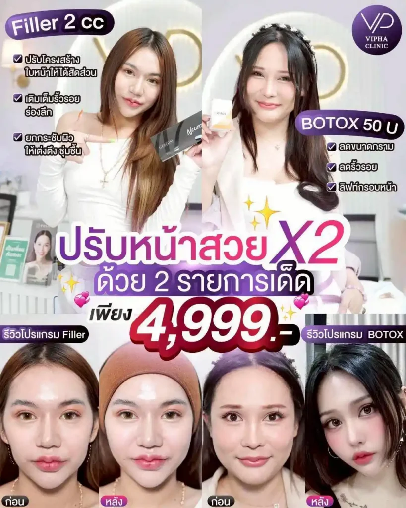 โปรโมชัน 12