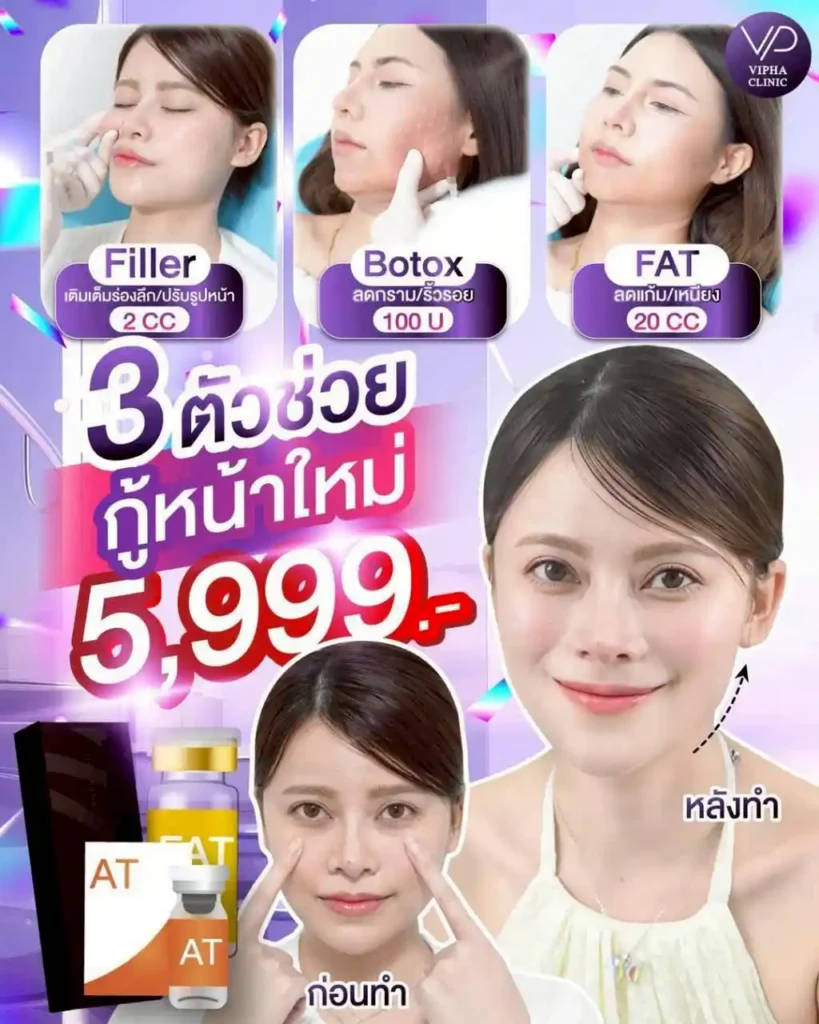 โปรโมชัน 19