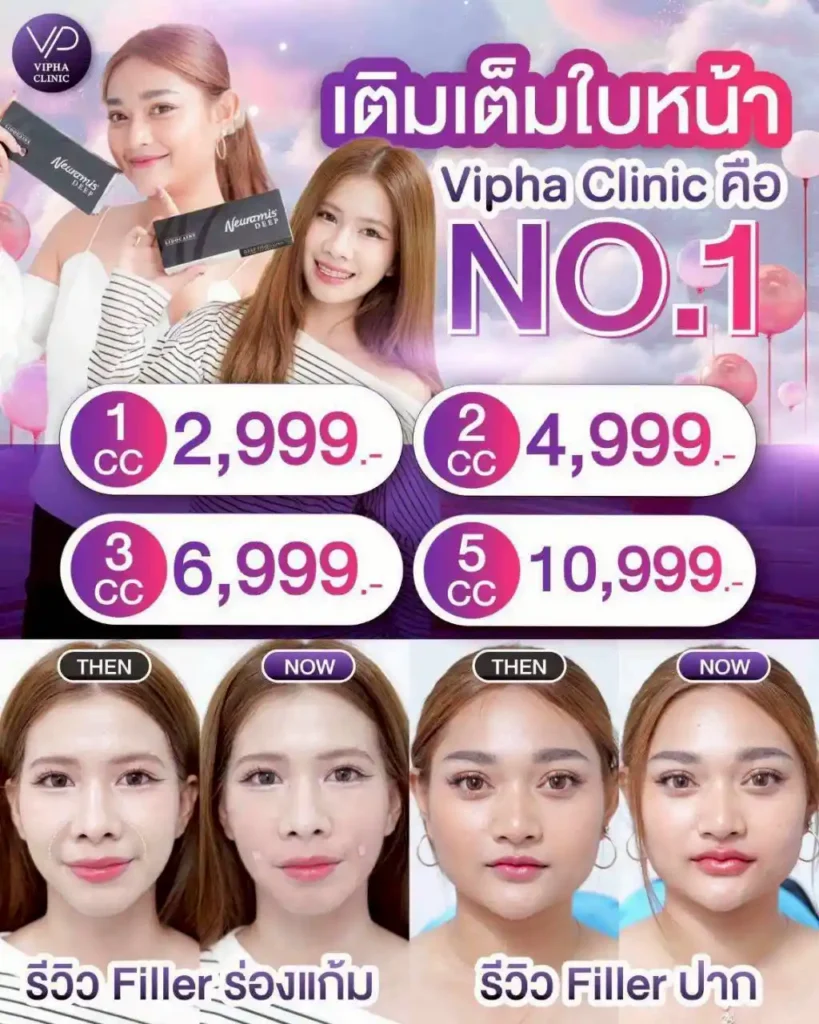 โปรโมชัน 20