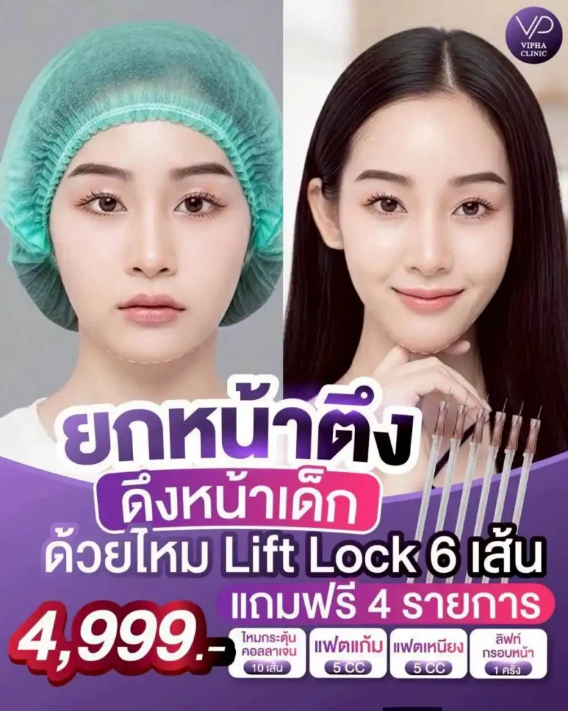 โปรโมชัน 22
