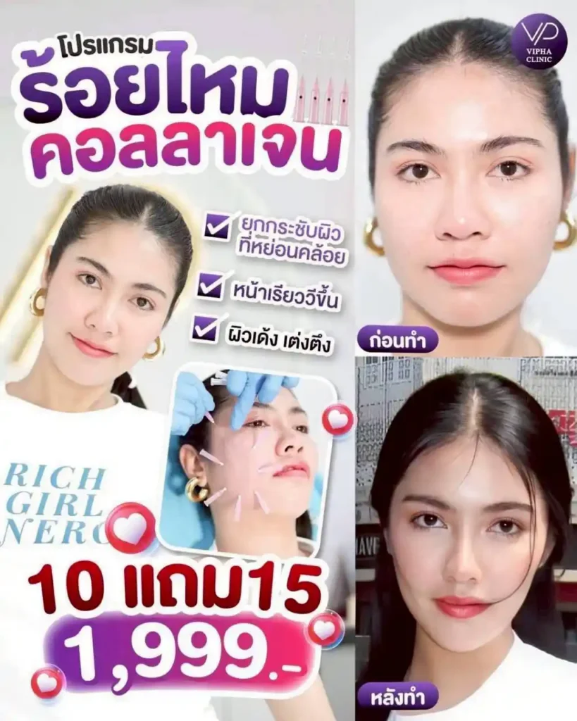 โปรโมชัน 29