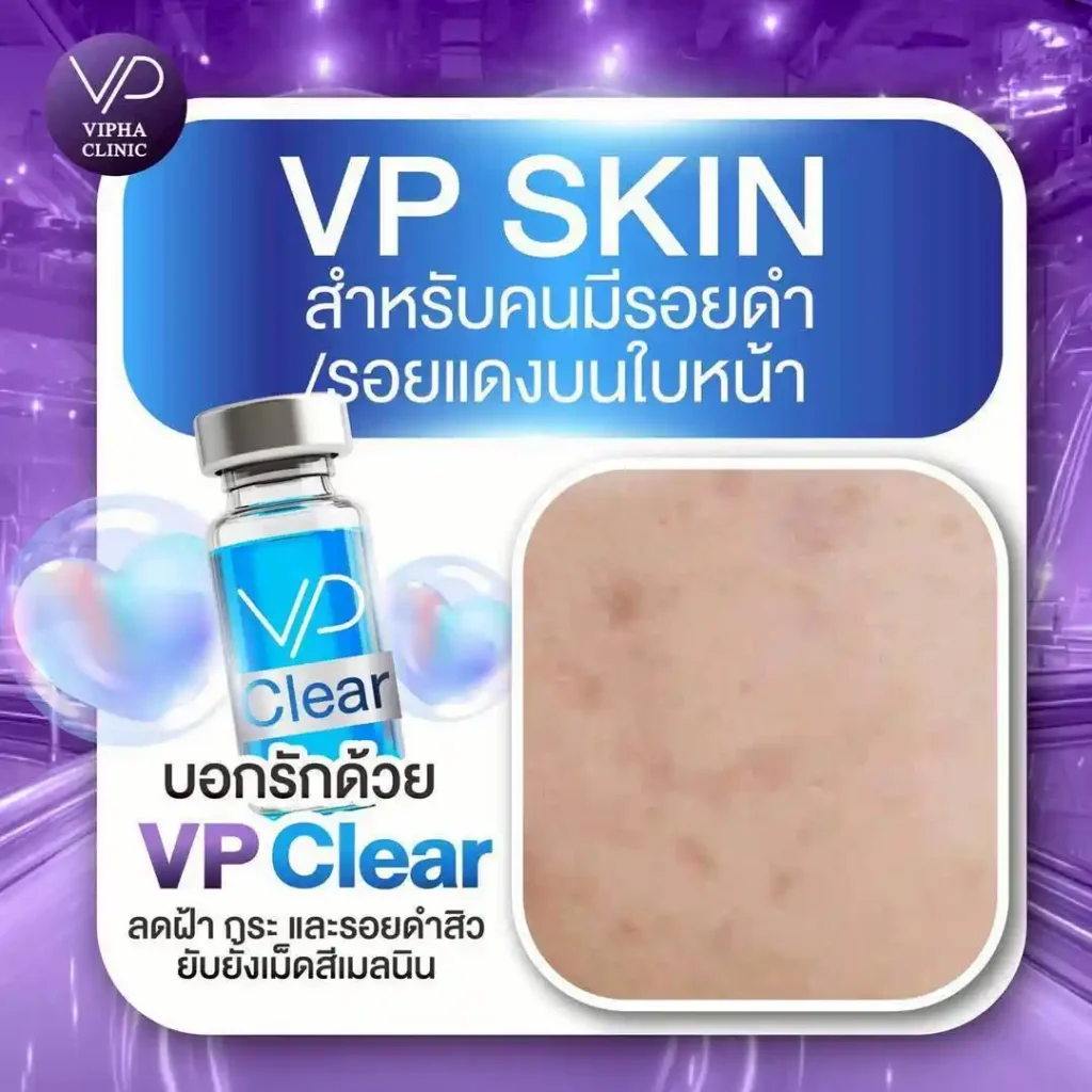 รูปรีวิว 03