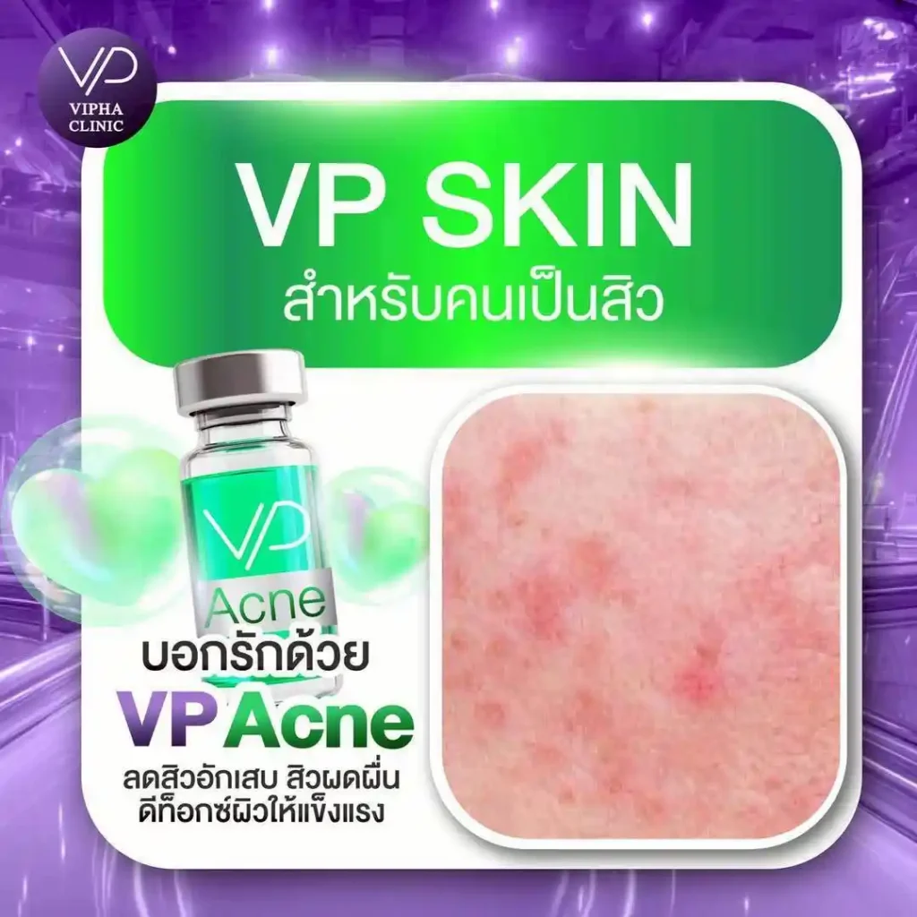 รูปรีวิว 05