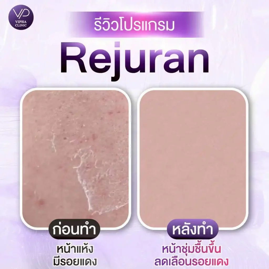 รูปรีวิว 07