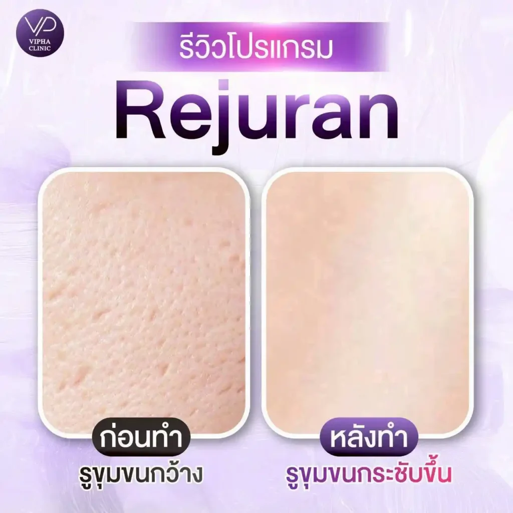 รูปรีวิว 08