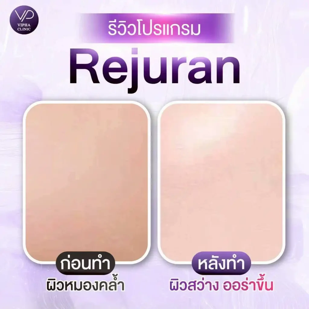 รูปรีวิว 09