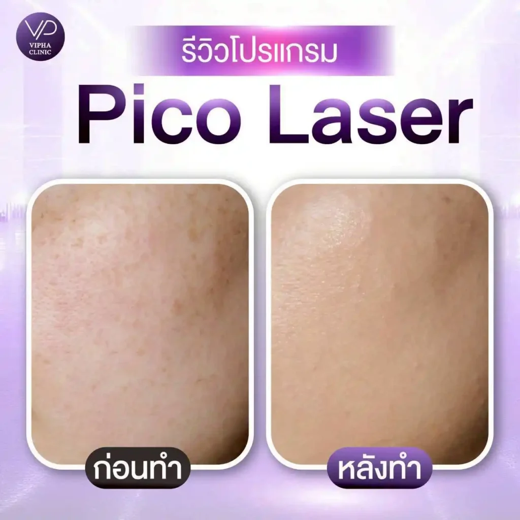 รูปรีวิว 10