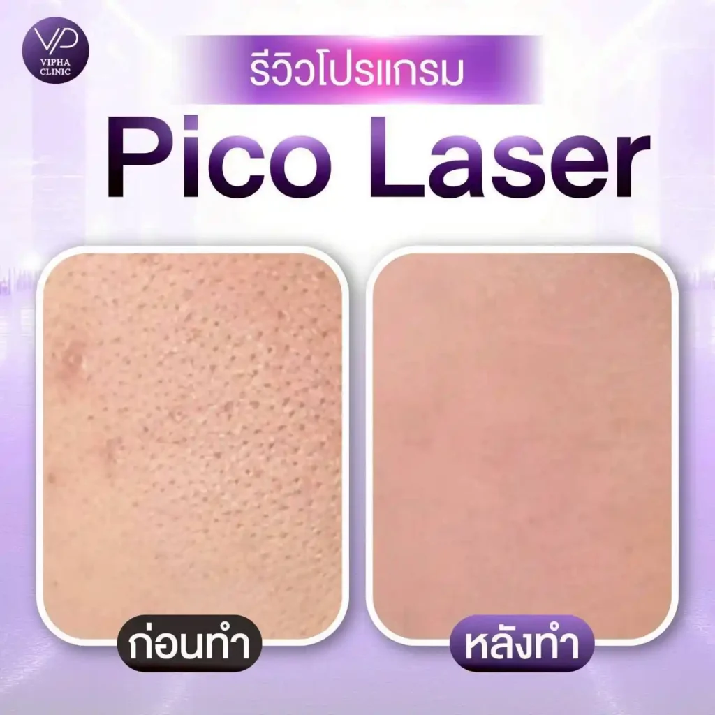 รูปรีวิว 11
