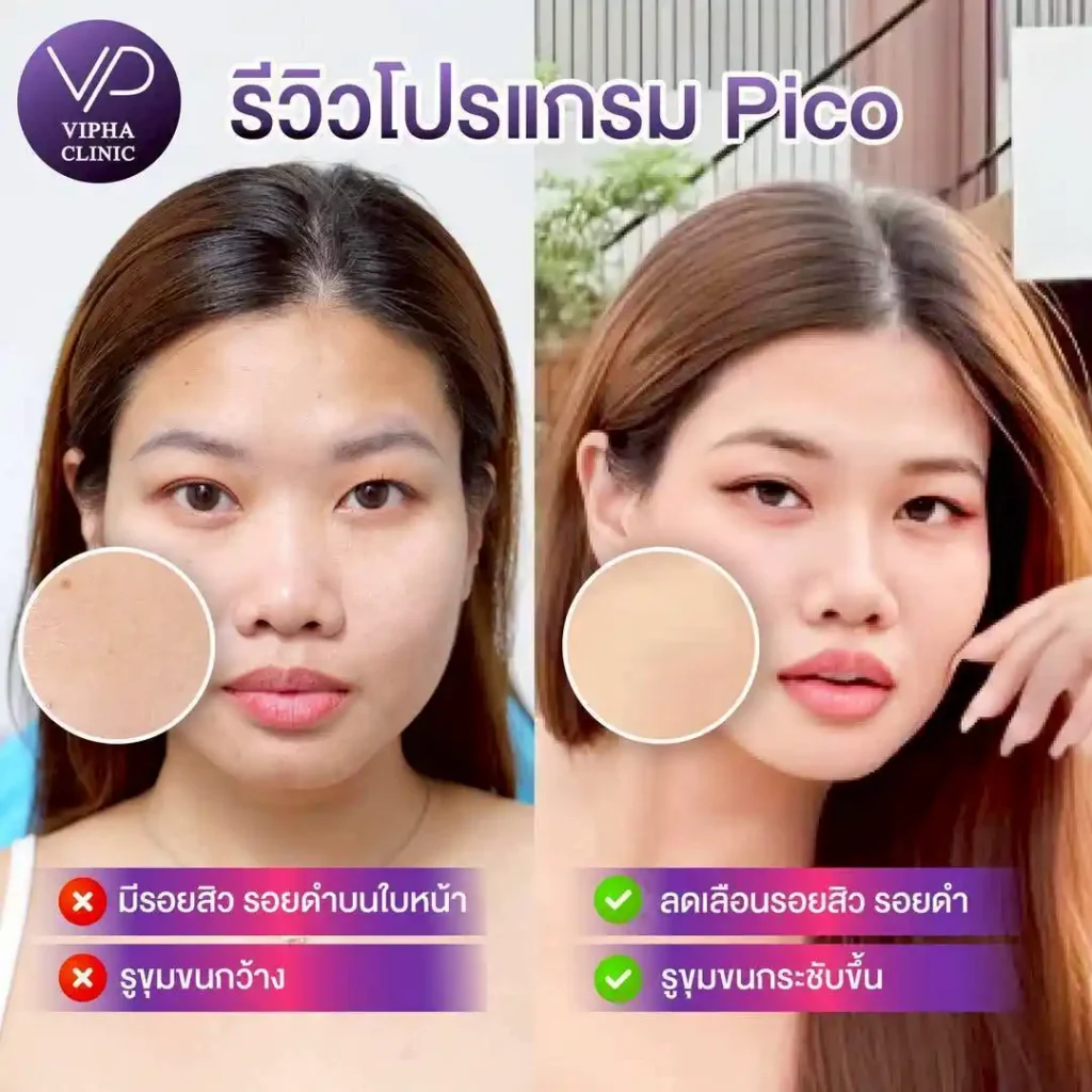 รูปรีวิว 14