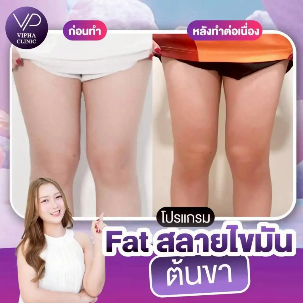 รูปรีวิว 16