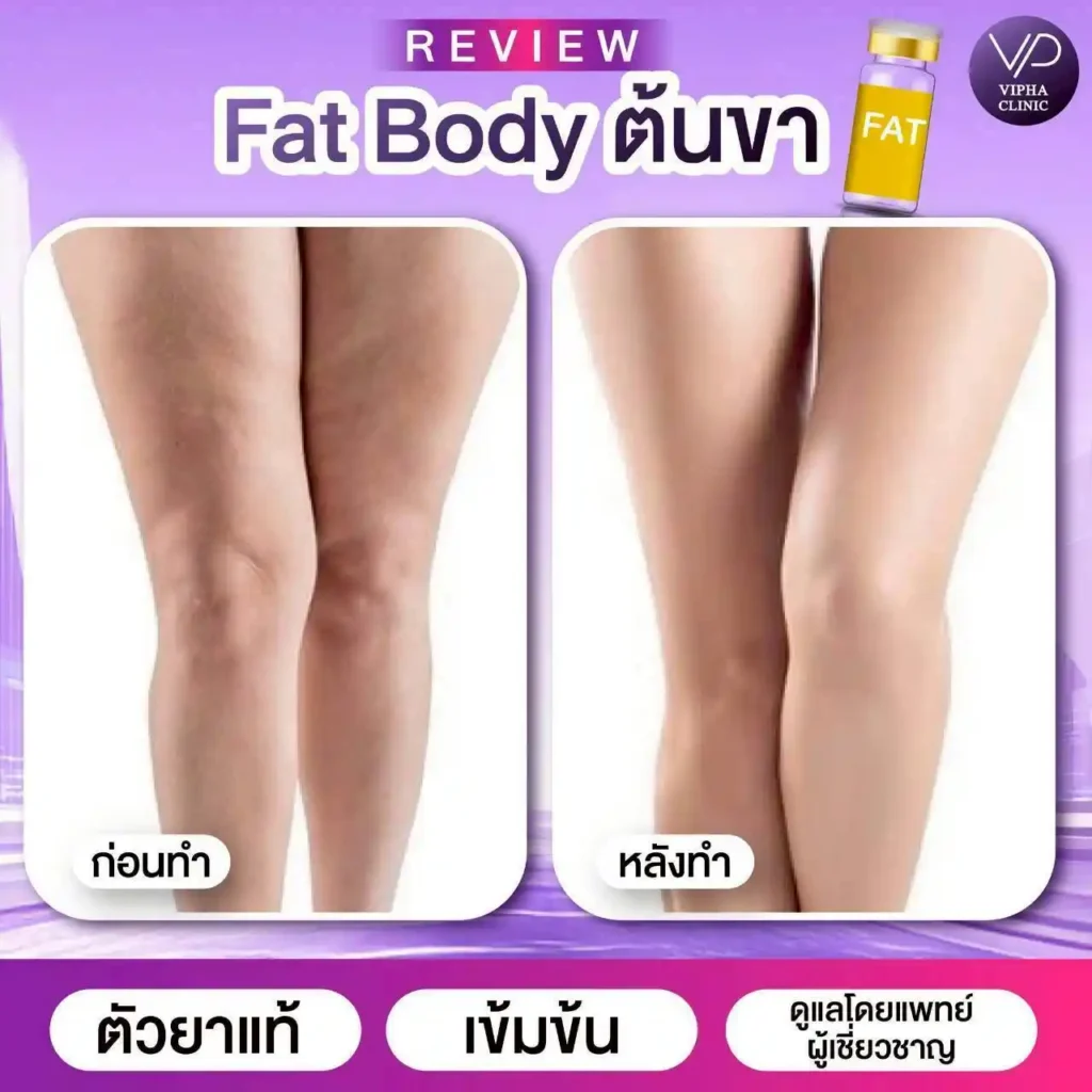 รูปรีวิว 18