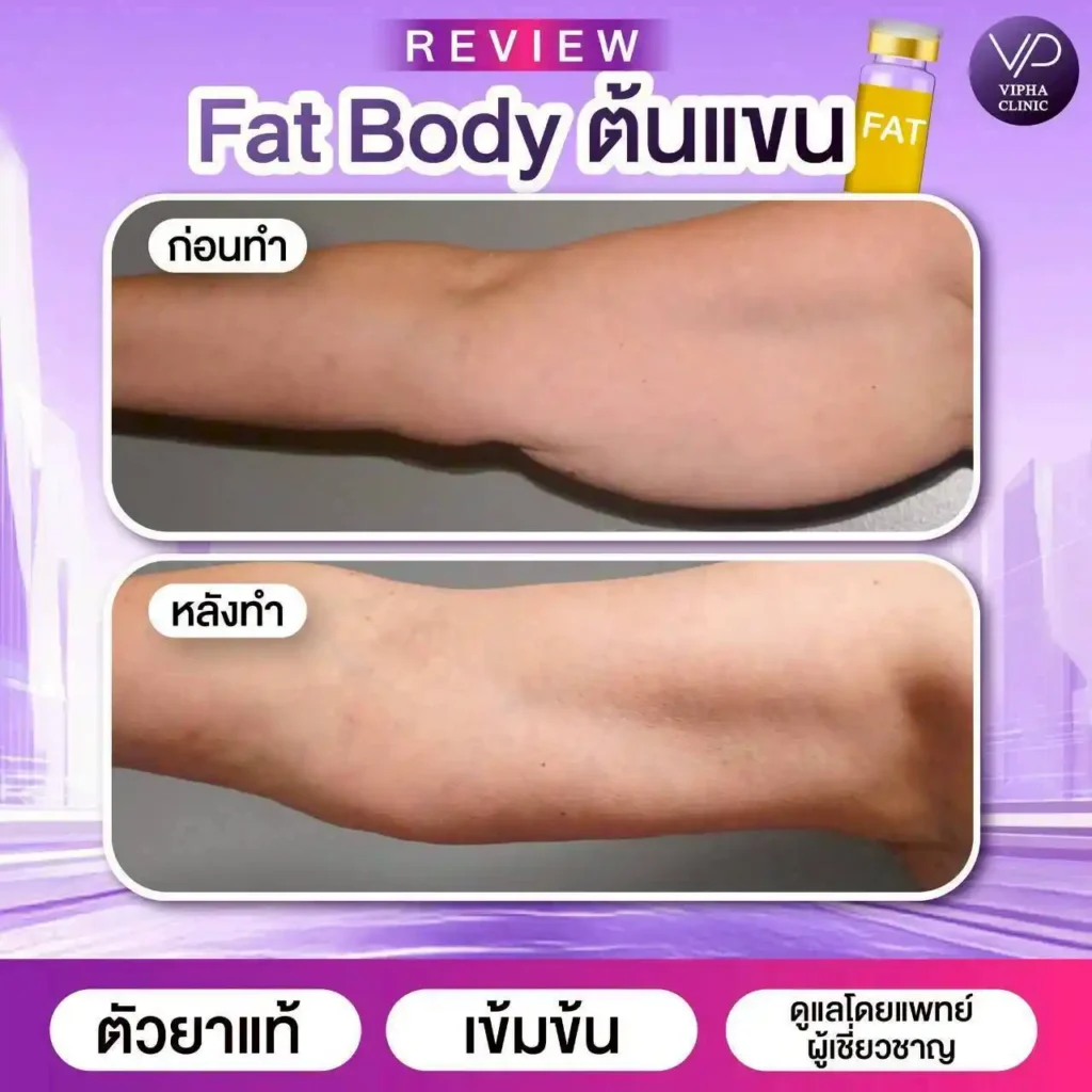 รูปรีวิว 20