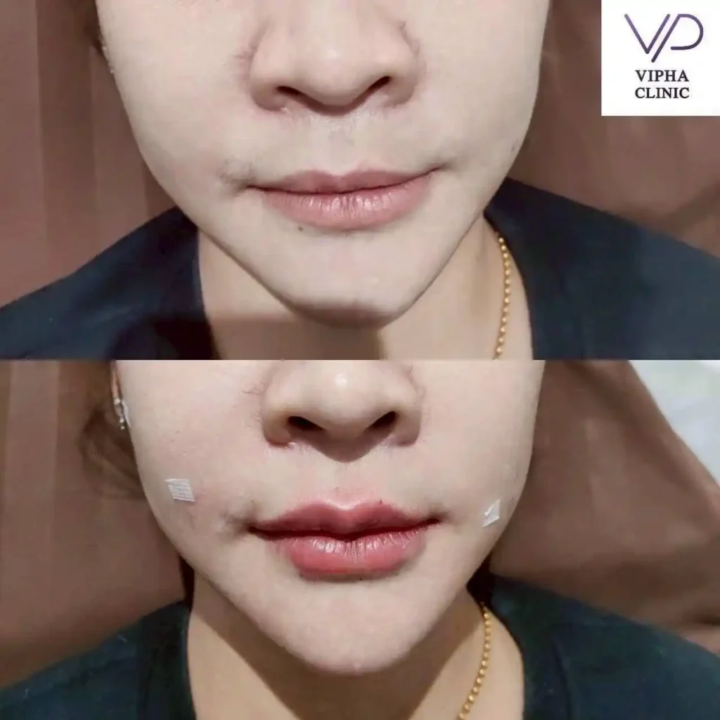 รูปรีวิว 27