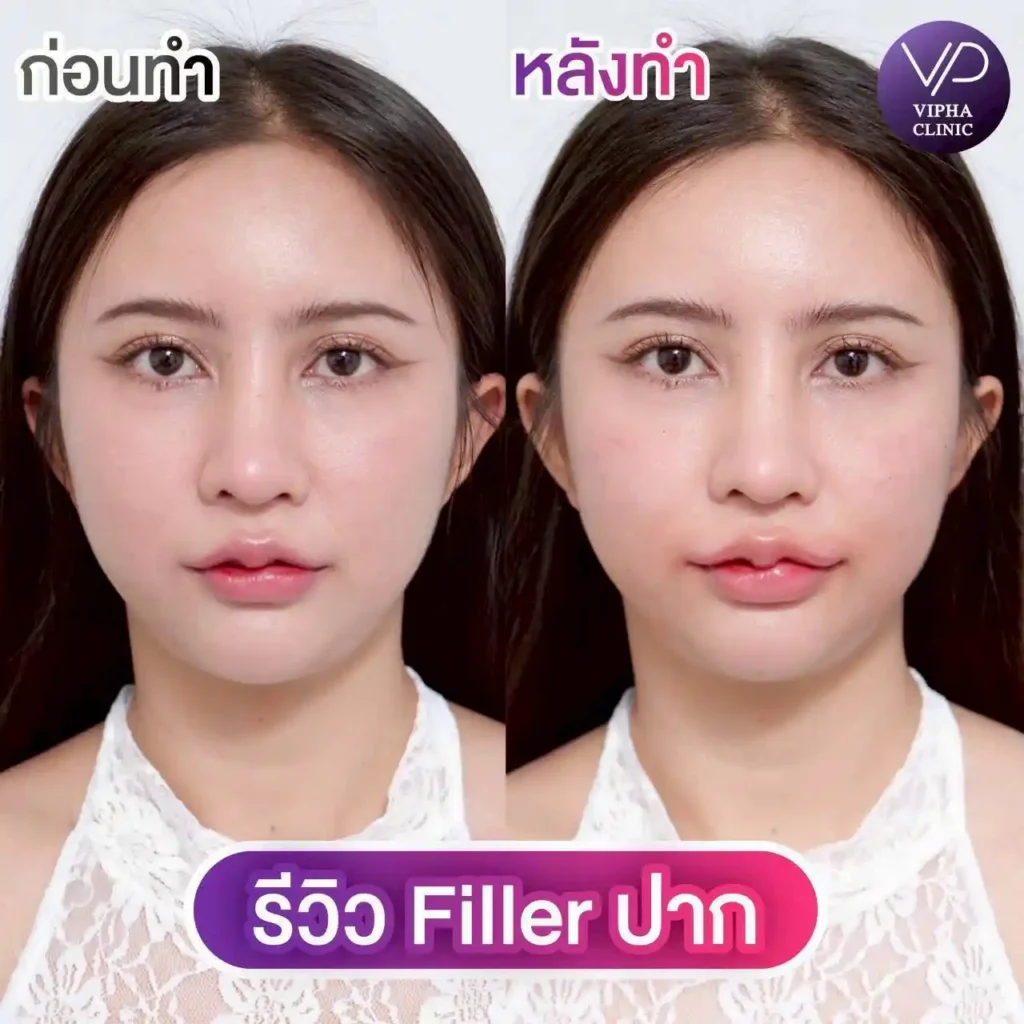 รูปรีวิว 31