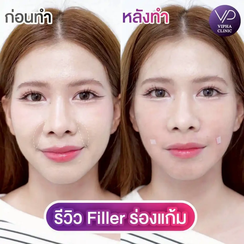 รูปรีวิว 32