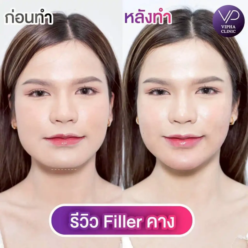 รูปรีวิว 33