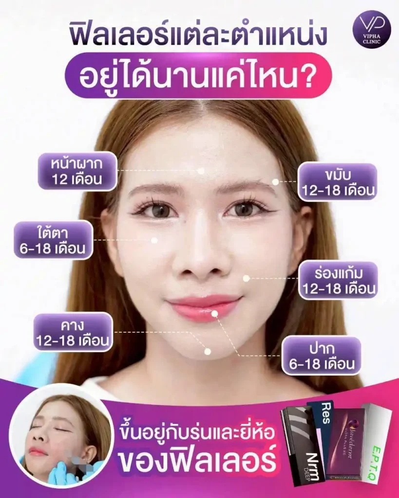 รูปรีวิว 34