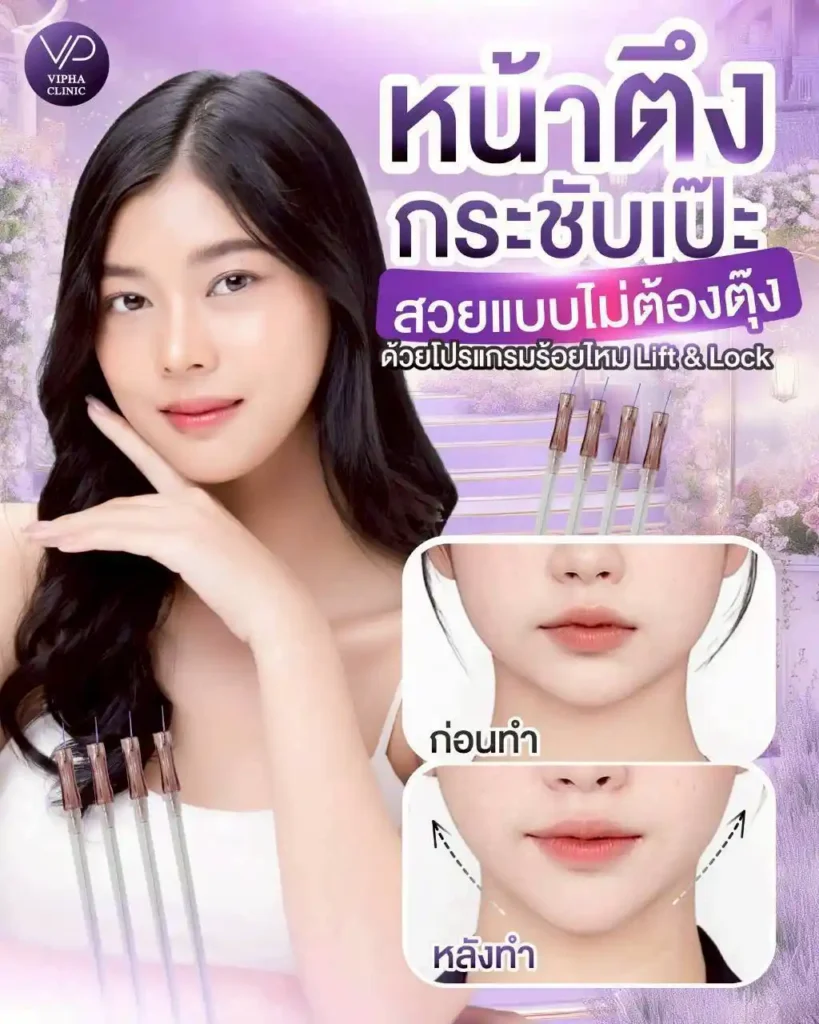รูปรีวิว 38