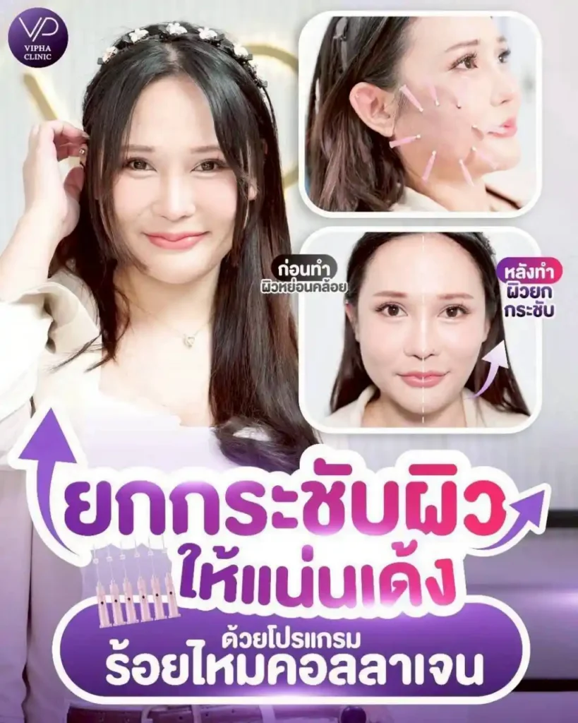 รูปรีวิว 39