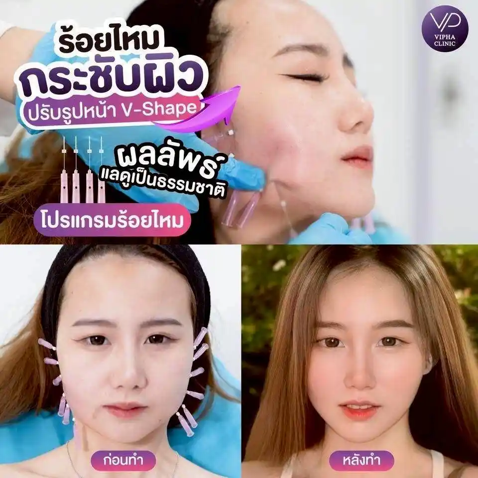 รูปรีวิว 40