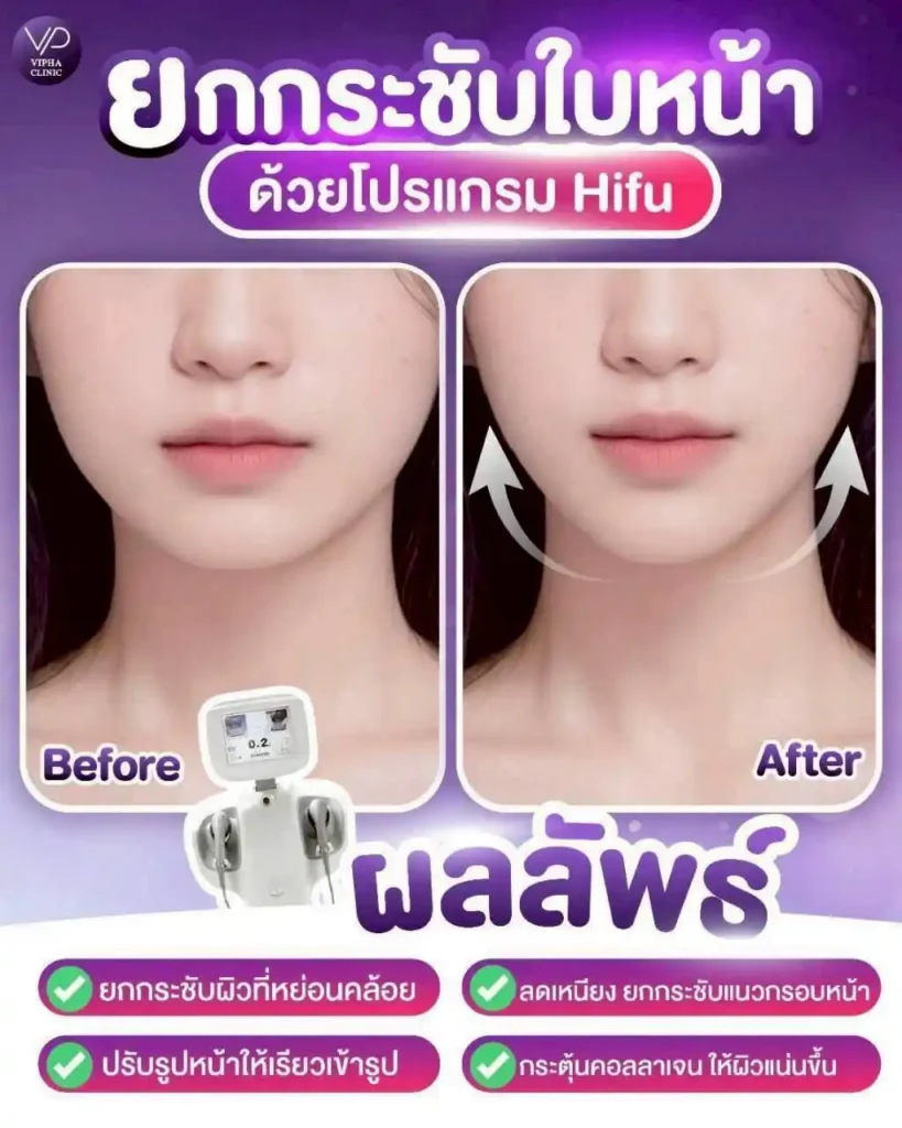 รูปรีวิว 41