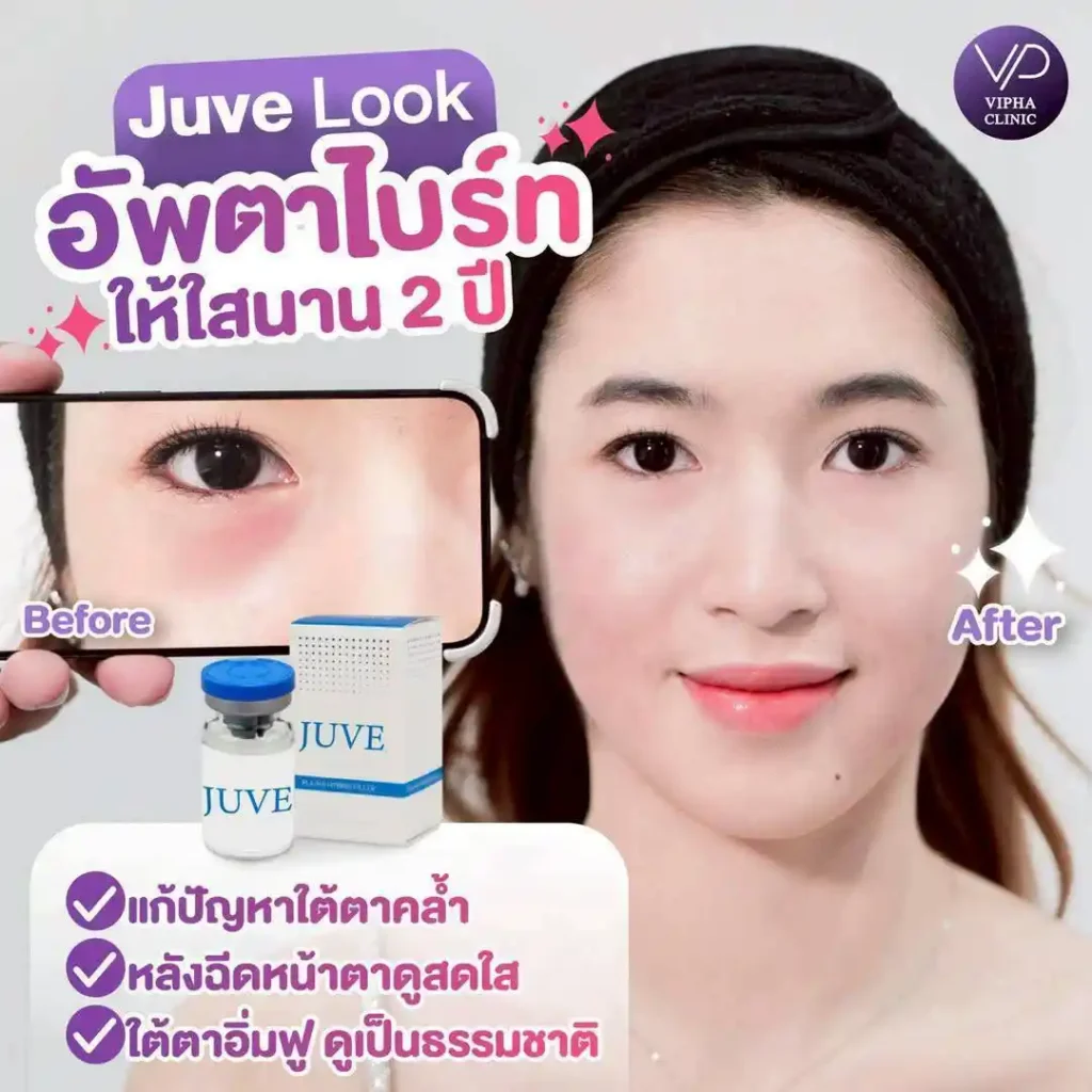 รูปรีวิว 47