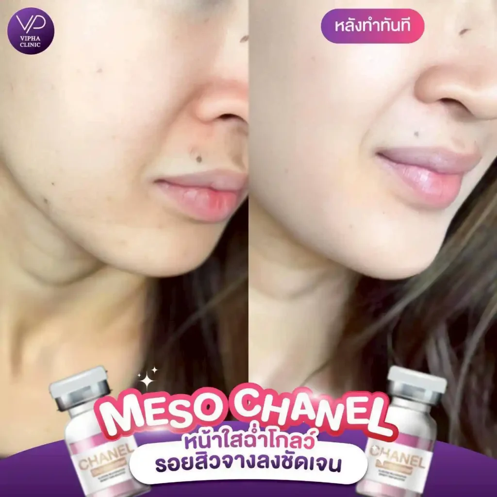 รูปรีวิว 52