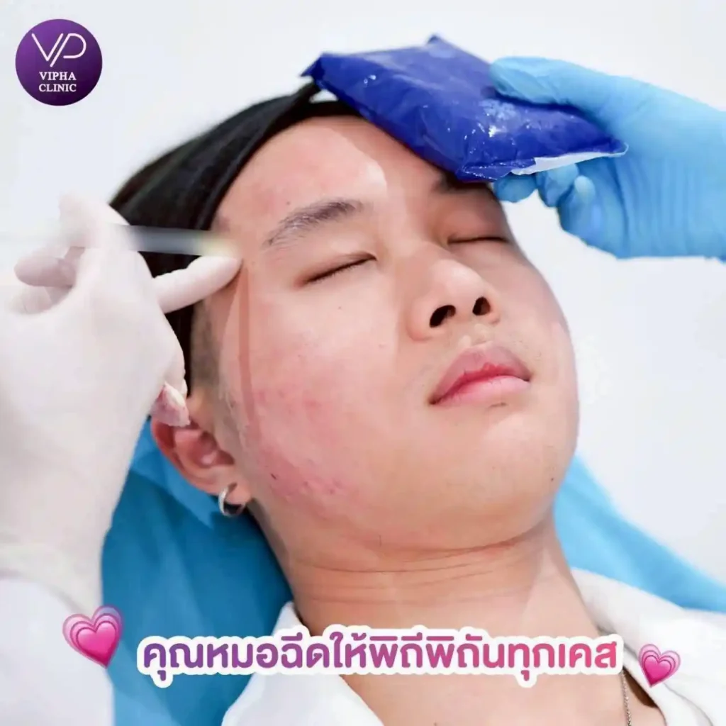 รูปรีวิว 54
