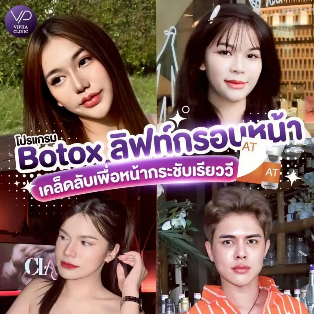 รูปรีวิว 56