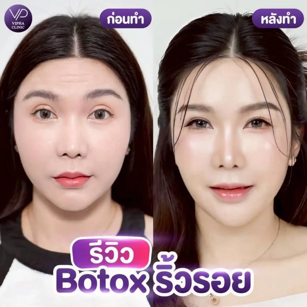 รูปรีวิว 58