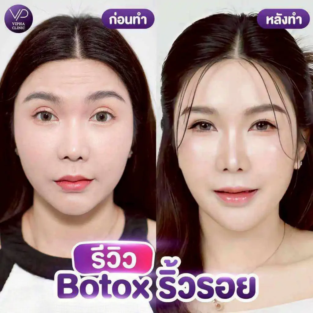 รูปรีวิว 60