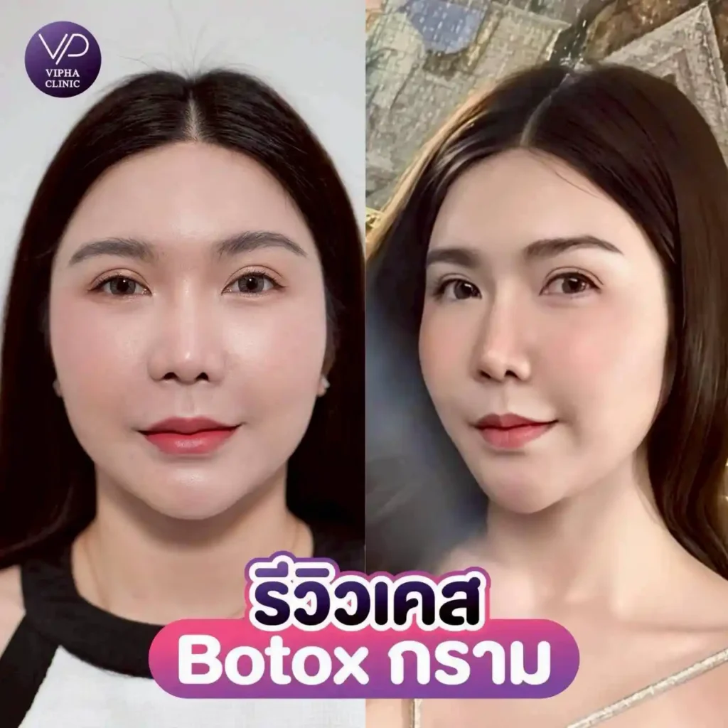 รูปรีวิว 61