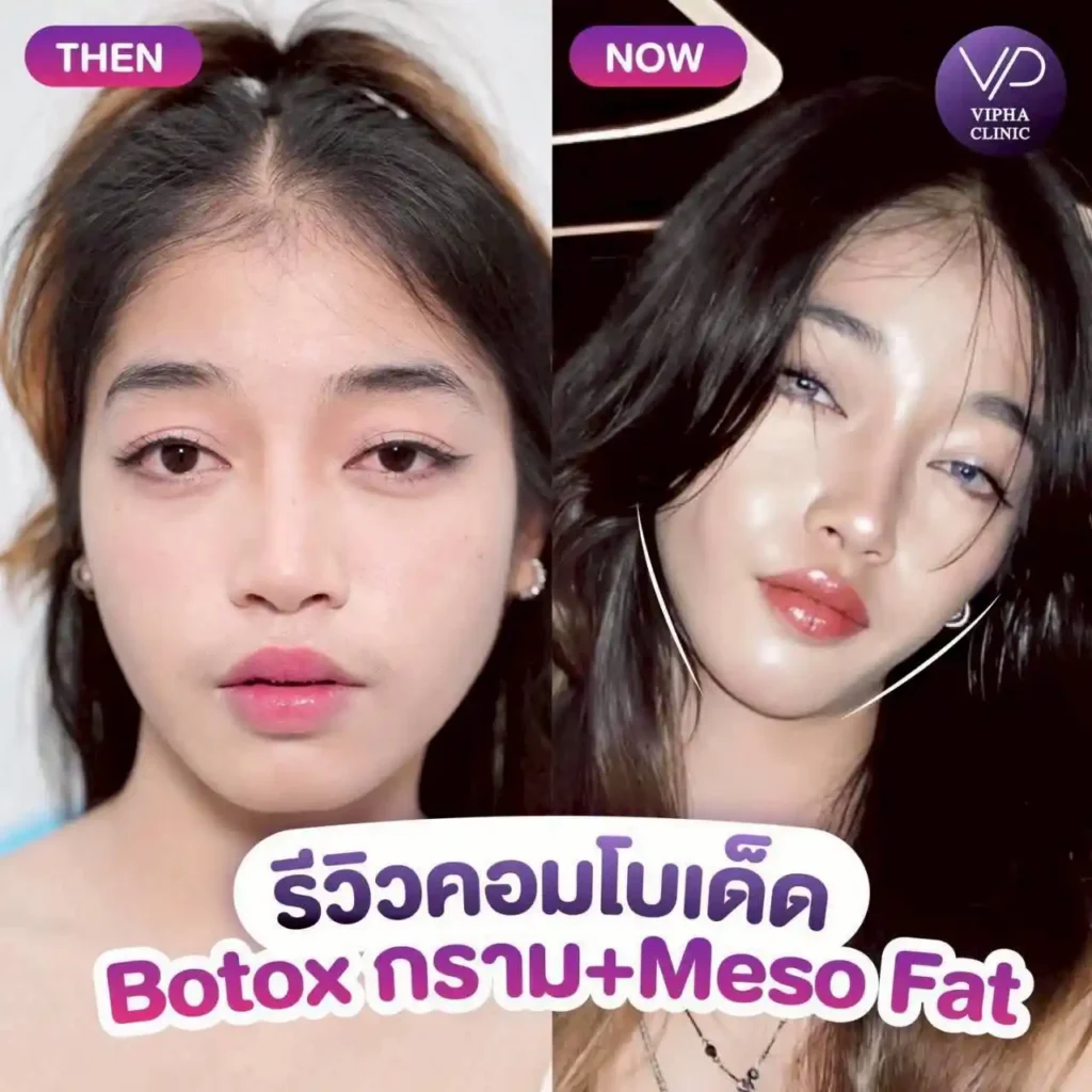 รูปรีวิว 65