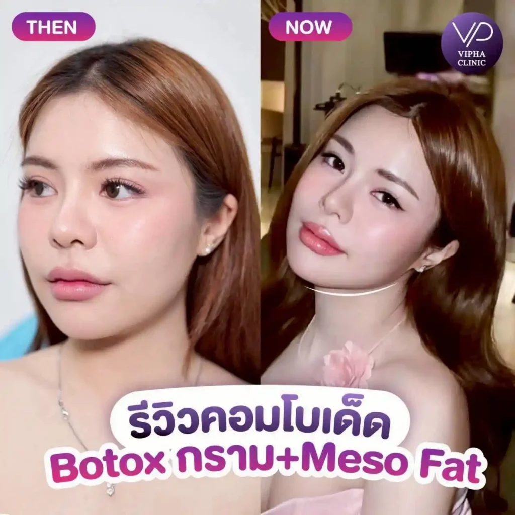 รูปรีวิว 66