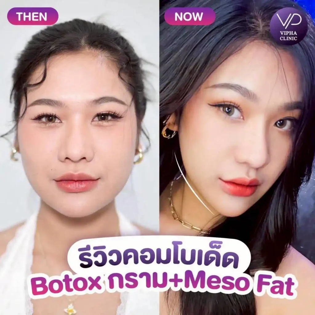 รูปรีวิว 67