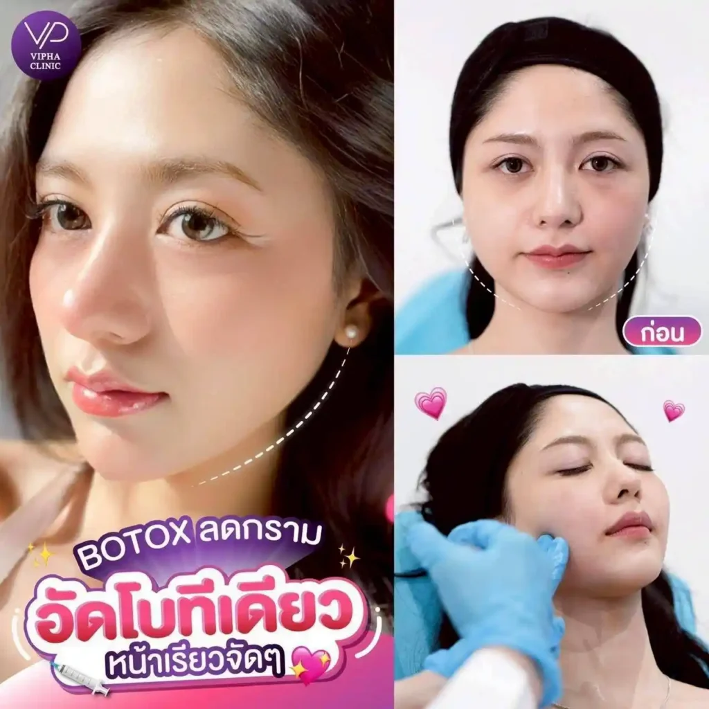 รูปรีวิว 74
