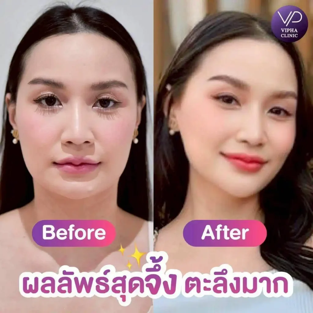 รูปรีวิว 75