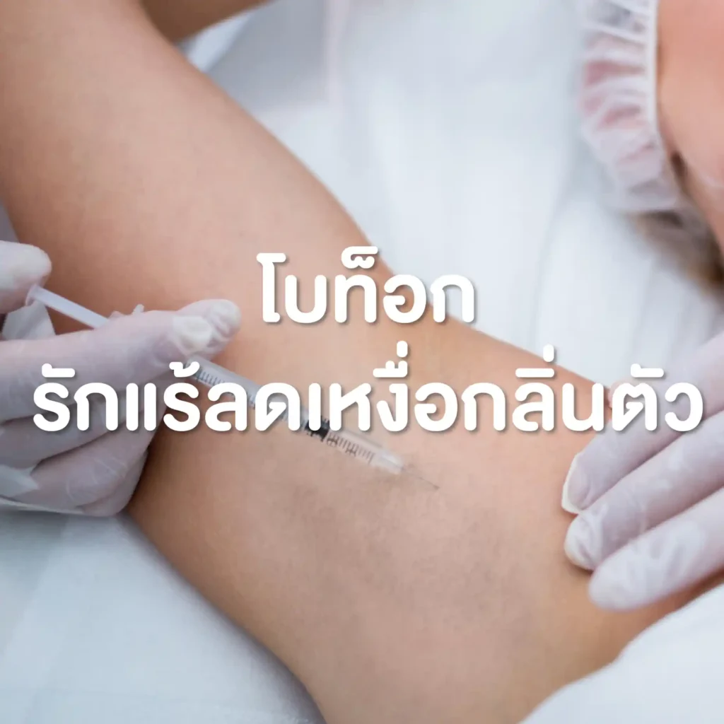 โปรแกรมโบท็อกรักแร้ลดเหงื่อกลิ่นตัว